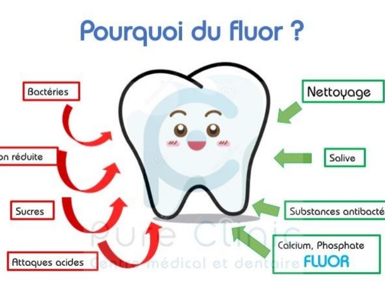 hygiène bucco-dentaire plus le fluor pour éviter la carie dentaire